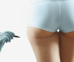 lipoaspiration tournai