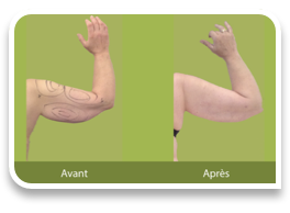 collage image title